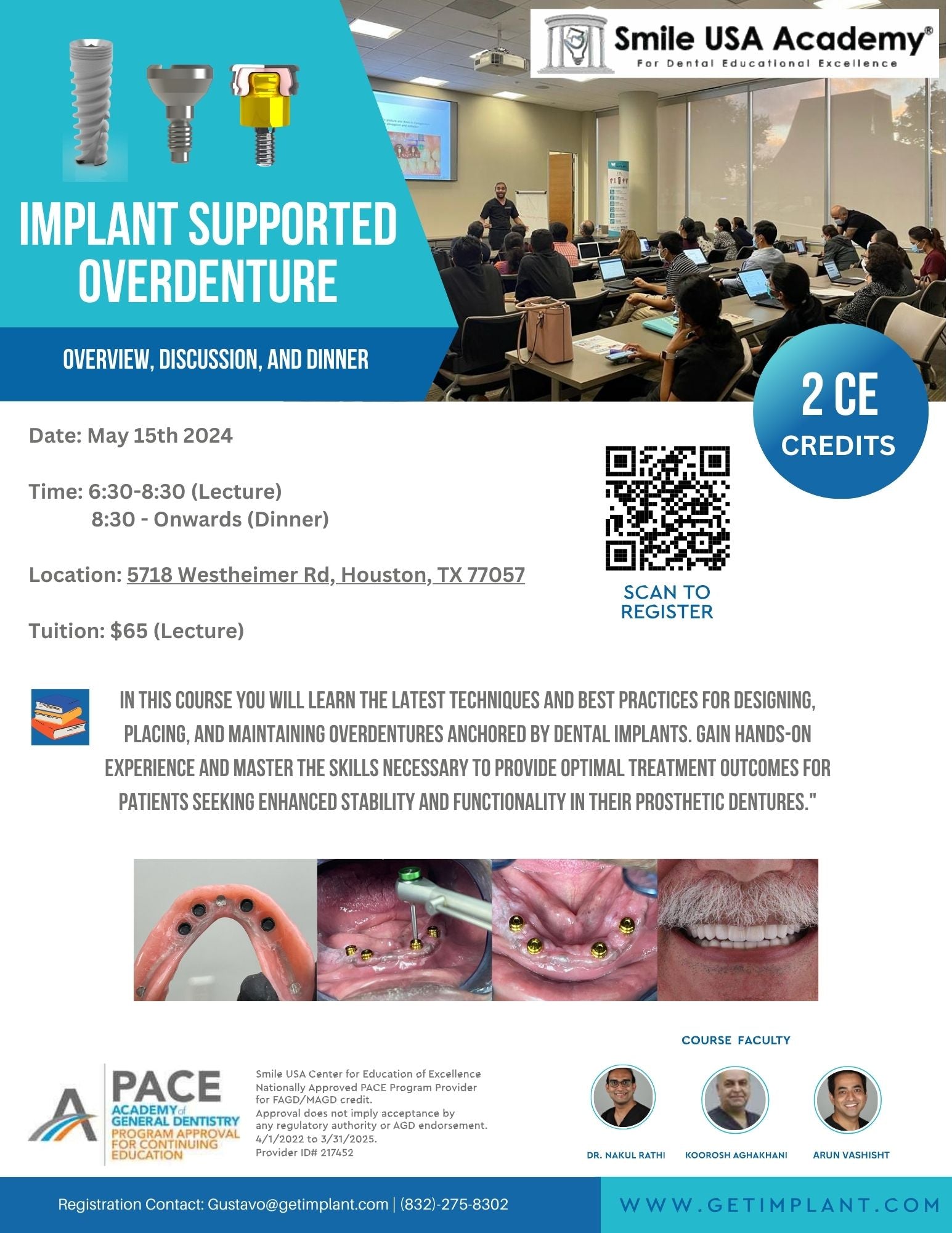 Implant Overdentures - Houston